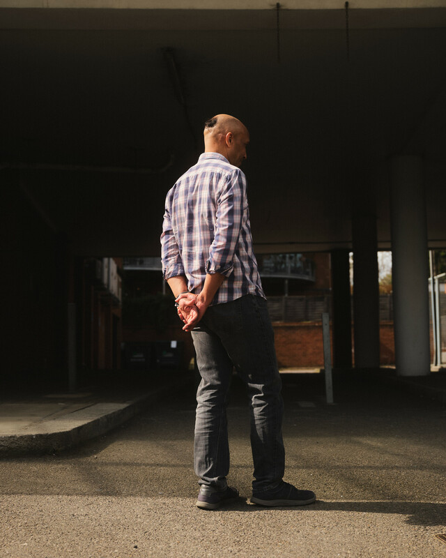 A man with a hair patch stands outside near the shadows of his housing complex.